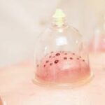 best hijama and homeopathic services